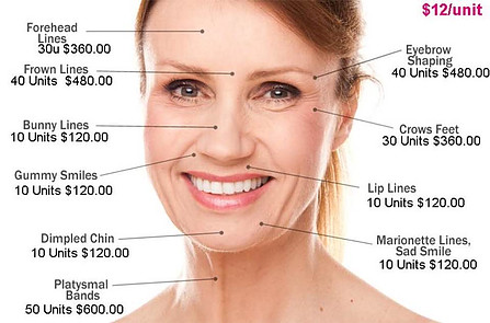 How much people spend on Botox